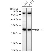 Western blot analysis of various lysates, using FGF14 Antibody at 1/1000 dilution. Secondary antibody: HRP-conjugated Goat anti-Rabbit IgG (H+L) at 1/10000 dilution. Lysates/proteins: 25 µg per lane. Blocking buffer: 3% nonfat dry milk in TBST. Exposure time: 60s.