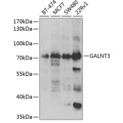 Western blot analysis of various lysates using GALNT3 Antibody at 1/1000 dilution. Secondary antibody: HRP-conjugated Goat anti-Rabbit IgG (H+L) at 1/10000 dilution. Lysates/proteins: 25 µg per lane. Blocking buffer: 3% nonfat dry milk in TBST. Exposure time: 90s.