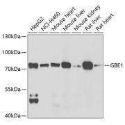 Western blot analysis of various lysates using GBE1 Antibody at 1/1000 dilution. Secondary antibody: HRP-conjugated Goat anti-Rabbit IgG (H+L) at 1/10000 dilution. Lysates/proteins: 25 µg per lane. Blocking buffer: 3% nonfat dry milk in TBST. Exposure time: 90s.