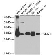 Western blot analysis of various lysates using GNMT Antibody at 1/1000 dilution. Secondary antibody: HRP-conjugated Goat anti-Rabbit IgG (H+L) at 1/10000 dilution. Lysates/proteins: 25 µg per lane. Blocking buffer: 3% nonfat dry milk in TBST. Exposure time: 90s.