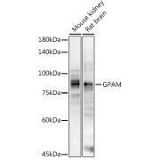 Western blot analysis of various lysates using at 1/1000 dilution. Secondary antibody: HRP-conjugated Goat anti-Rabbit IgG (H+L) at 1/10000 dilution. Lysates/proteins: 25 µg per lane. Blocking buffer: 3% nonfat dry milk in TBST. Exposure time: 30s.