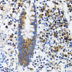 Hypoxia Up-Regulated 1 (HYOU1) Antibody