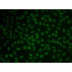 RNA-Binding Protein T-Star (KHDRBS3) Antibody