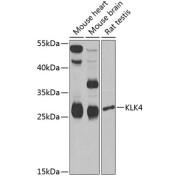 Western blot analysis of various lysates using KLK4 Antibody at 1/1000 dilution. Secondary antibody: HRP-conjugated Goat anti-Rabbit IgG (H+L) at 1/10000 dilution. Lysates/proteins: 25 µg per lane. Blocking buffer: 3% nonfat dry milk in TBST. Exposure time: 30s.