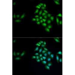 Kallikrein 4 (KLK4) Antibody