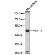 Western blot analysis of lysates from mouse lung, using MMP19 Antibody at 1/1000 dilution. Secondary antibody: HRP-conjugated Goat anti-Rabbit IgG (H+L) at 1/10000 dilution. Lysates/proteins: 25 µg per lane. Blocking buffer: 3% nonfat dry milk in TBST. Exposure time: 90s.