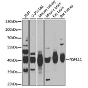 Western blot analysis of various lysates using NSFL1C Antibody at 1/1000 dilution. Secondary antibody: HRP-conjugated Goat anti-Rabbit IgG (H+L) at 1/10000 dilution. Lysates/proteins: 25 µg per lane. Blocking buffer: 3% nonfat dry milk in TBST. Exposure time: 1s.