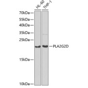 Western blot analysis of various lysates using PLA2G2D Antibody at 1/1000 dilution. Secondary antibody: HRP-conjugated Goat anti-Rabbit IgG (H+L) at 1/10000 dilution. Lysates/proteins: 25 µg per lane. Blocking buffer: 3% nonfat dry milk in TBST. Exposure time: 90s.