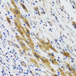 Phospholipase A2, Group II D (PLA2G2D) Antibody