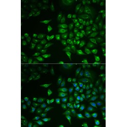 Phospholipase A2, Group II D (PLA2G2D) Antibody