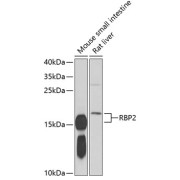 Western blot analysis of various lysates using RBP2 Antibody at 1/1000 dilution. Secondary antibody: HRP-conjugated Goat anti-Rabbit IgG (H+L) at 1/10000 dilution. Lysates/proteins: 25 µg per lane. Blocking buffer: 3% nonfat dry milk in TBST. Exposure time: 60s.