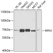 Western blot analysis of various lysates using RPN1 Antibody at 1/1000 dilution. Secondary antibody: HRP-conjugated Goat anti-Rabbit IgG (H+L) at 1/10000 dilution. Lysates/proteins: 25 µg per lane. Blocking buffer: 3% nonfat dry milk in TBST. Exposure time: 90s.