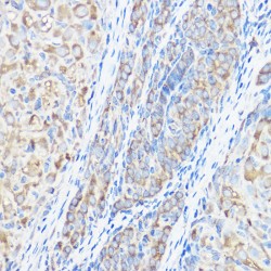 Serine--tRNA Ligase, Cytoplasmic (SARS1) Antibody