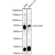 Western blot analysis of various lysates, using SLC23A2 Antibody at 1/2000 dilution. Secondary antibody: HRP-conjugated Goat anti-Rabbit IgG (H+L) at 1/10000 dilution. Lysates/proteins: 25 µg per lane. Blocking buffer: 3% nonfat dry milk in TBST. Exposure time: 90s.