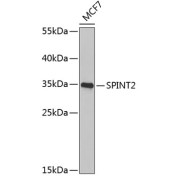 Western blot analysis of lysates from MCF-7 cells, using SPINT2 Antibody at 1/1000 dilution. Secondary antibody: HRP-conjugated Goat anti-Rabbit IgG (H+L) at 1/10000 dilution. Lysates/proteins: 25 µg per lane. Blocking buffer: 3% nonfat dry milk in TBST. Exposure time: 10s.