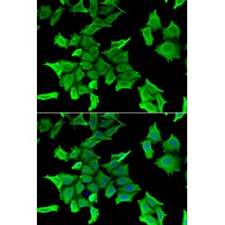 Serine Peptidase Inhibitor Kunitz Type 2 (SPINT2) Antibody