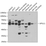 Western blot analysis of various lysates using SPTLC1 Antibody at 1/1000 dilution. Secondary antibody: HRP-conjugated Goat anti-Rabbit IgG (H+L) at 1/10000 dilution. Lysates/proteins: 25 µg per lane. Blocking buffer: 3% nonfat dry milk in TBST. Exposure time: 90s.