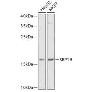 Western blot analysis of various lysates using SRP19 Antibody at 1/1000 dilution. Secondary antibody: HRP-conjugated Goat anti-Rabbit IgG (H+L) at 1/10000 dilution. Lysates/proteins: 25 µg per lane. Blocking buffer: 3% nonfat dry milk in TBST. Exposure time: 90s.