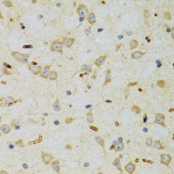 Signal Recognition Particle 19 (SRP19) Antibody