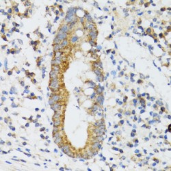 Signal Recognition Particle 19 (SRP19) Antibody