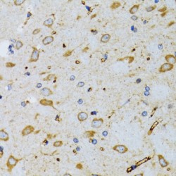 Signal Recognition Particle 19 (SRP19) Antibody