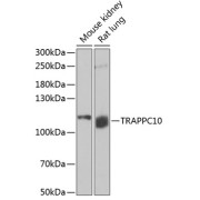 Western blot analysis of various lysates using TRAPPC10 Antibody at 1/1000 dilution. Secondary antibody: HRP-conjugated Goat anti-Rabbit IgG (H+L) at 1/10000 dilution. Lysates/proteins: 25 µg per lane. Blocking buffer: 3% nonfat dry milk in TBST. Exposure time: 15min.