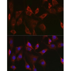 Thioredoxin 2, Mitochondrial (TXN2) Antibody