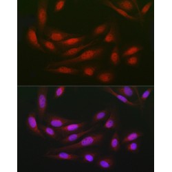 DDB1 And CUL4 Associated Factor 7 (DCAF7) Antibody