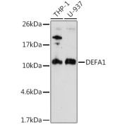 Western blot analysis of various lysates using DEFA1 Antibody at 1/1000 dilution. Secondary antibody: HRP-conjugated Goat anti-Rabbit IgG (H+L) at 1/10000 dilution. Lysates/proteins: 25 µg per lane. Blocking buffer: 3% nonfat dry milk in TBST. Exposure time: 180s.