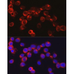 Defensin Alpha 1, Neutrophil (DEFA1) Antibody