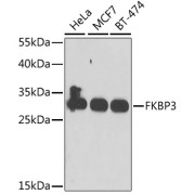 Western blot analysis of various lysates using FKBP3 Antibody at 1/1000 dilution. Secondary antibody: HRP-conjugated Goat anti-Rabbit IgG (H+L) at 1/10000 dilution. Lysates/proteins: 25 µg per lane. Blocking buffer: 3% nonfat dry milk in TBST. Exposure time: 30s.