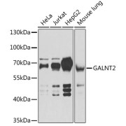 Western blot analysis of various lysates using GALNT2 Antibody at 1/1000 dilution. Secondary antibody: HRP-conjugated Goat anti-Rabbit IgG (H+L) at 1/10000 dilution. Lysates/proteins: 25 µg per lane. Blocking buffer: 3% nonfat dry milk in TBST. Exposure time: 1s.