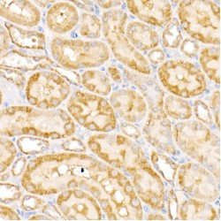 Polypeptide N-Acetylgalactosaminyltransferase 2 (GALNT2) Antibody