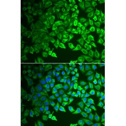 Gastric Intrinsic Factor (GIF) Antibody