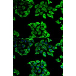 Peptidylprolyl Isomerase D / CYPD (PPID) Antibody