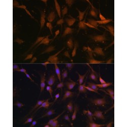 26S Proteasome Non-ATPase Regulatory Subunit 13 (PSMD13) Antibody