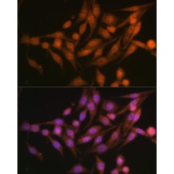 26S Proteasome Non-ATPase Regulatory Subunit 13 (PSMD13) Antibody