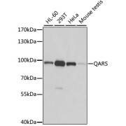 Western blot analysis of various lysates using QARS Antibody at 1/1000 dilution. Secondary antibody: HRP-conjugated Goat anti-Rabbit IgG (H+L) at 1/10000 dilution. Lysates/proteins: 25 µg per lane. Blocking buffer: 3% nonfat dry milk in TBST. Exposure time: 1s.