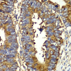 Glutaminyl tRNA Synthetase (QARS) Antibody