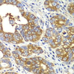 Glutaminyl tRNA Synthetase (QARS) Antibody