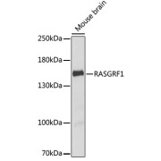 Western blot analysis of lysates from mouse brain, using RASGRF1 Antibody at 1/1000 dilution. Secondary antibody: HRP-conjugated Goat anti-Rabbit IgG (H+L) at 1/10000 dilution. Lysates/proteins: 25 µg per lane. Blocking buffer: 3% nonfat dry milk in TBST. Exposure time: 90s.