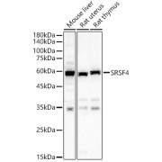 Western blot analysis of various lysates, using SRSF4 Antibody at 1/2000 dilution. Secondary antibody: HRP-conjugated Goat anti-Rabbit IgG (H+L) at 1/10000 dilution. Lysates/proteins: 25 µg per lane. Blocking buffer: 3% nonfat dry milk in TBST. Exposure time: 60s.