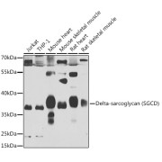 Western blot analysis of various lysates using Delta-sarcoglycan (SGCD) Antibody at 1/1000 dilution. Secondary antibody: HRP-conjugated Goat anti-Rabbit IgG (H+L) at 1/10000 dilution. Lysates/proteins: 25 µg per lane. Blocking buffer: 3% nonfat dry milk in TBST. Exposure time: 90s.