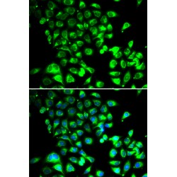 Single Stranded DNA Binding Protein 1 (SSBP1) Antibody