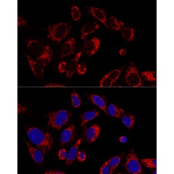 Single Stranded DNA Binding Protein 1 (SSBP1) Antibody