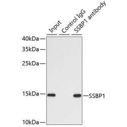 Single Stranded DNA Binding Protein 1 (SSBP1) Antibody