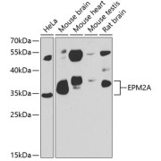 Western blot analysis of various lysates using EPM2A Antibody at 1/1000 dilution. Secondary antibody: HRP-conjugated Goat anti-Rabbit IgG (H+L) at 1/10000 dilution. Lysates/proteins: 25 µg per lane. Blocking buffer: 3% nonfat dry milk in TBST. Exposure time: 90s.