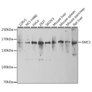 Western blot analysis of various lysates using SMC1 Antibody at 1/1000 dilution. Secondary antibody: HRP-conjugated Goat anti-Rabbit IgG (H+L) at 1/10000 dilution. Lysates/proteins: 25 µg per lane. Blocking buffer: 3% nonfat dry milk in TBST. Exposure time: 90s.