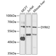 Western blot analysis of various lysates using DYRK2 Antibody at 1/1000 dilution. Secondary antibody: HRP-conjugated Goat anti-Rabbit IgG (H+L) at 1/10000 dilution. Lysates/proteins: 25 µg per lane. Blocking buffer: 3% nonfat dry milk in TBST. Exposure time: 5s.