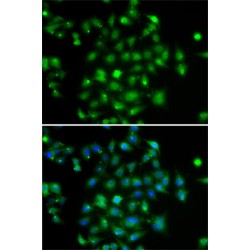 Dual Specificity Tyrosine-Phosphorylation-Regulated Kinase 2 (DYRK2) Antibody